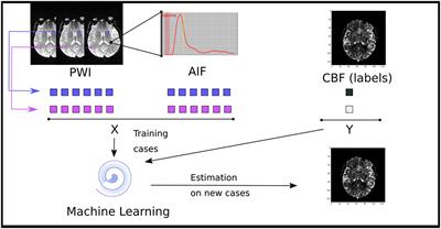 A Machine Learning Approach to Perfusion Imaging With Dynamic Susceptibility Contrast MR